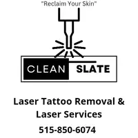 Cleanslate Laser Tattoo Removal
